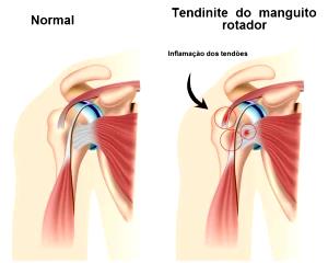 Quantas calorias em 1 Porção Manguito?